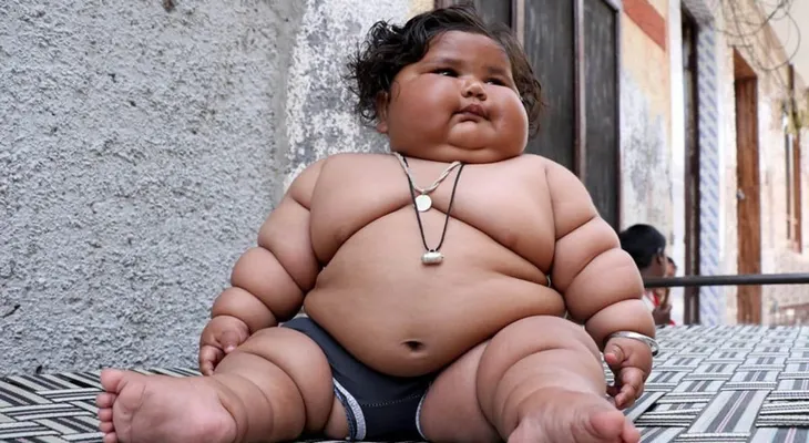 La bebé de 8 meses que pesa 17 kilos