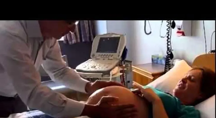 Un doctor cambia bebe de posición en el vientre de una manera asombrosa 