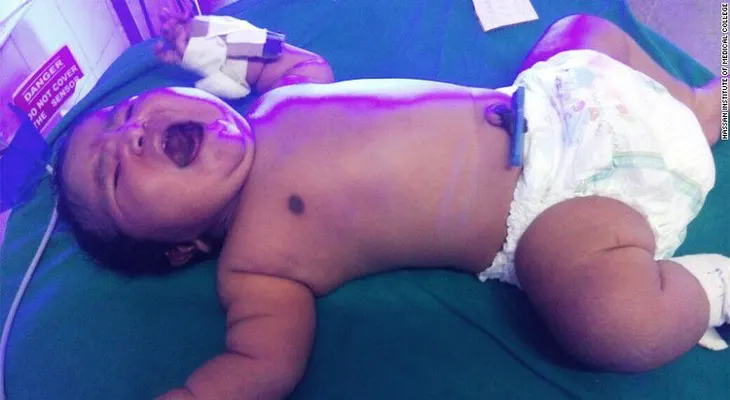 Esta podría ser la bebé más pesada de la India