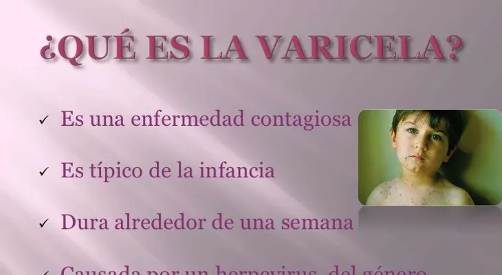 ¿Qué es la varicela, y qué hacer con esta enfermedad?