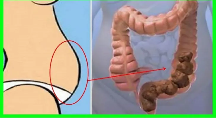 Una cucharada al día en ayunas puedes vaciar tu caca y limpiar tu intestino en dos minutos 