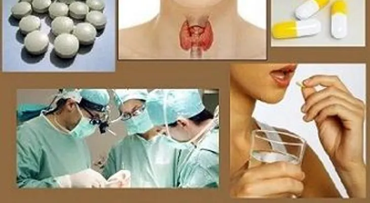 ¿Qué entendemos por hipertiroidismo?.Tratamiento