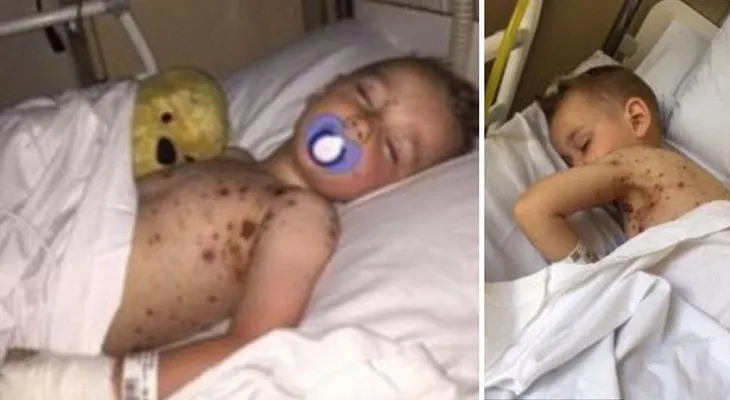 Un error de los médicos casi le cuesta la vida a este niño. ¡Todos los padres deben saberlo!