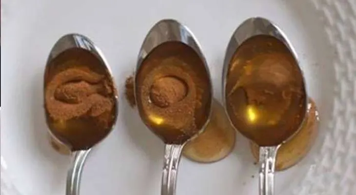 Con este remedio puede reducir el colesterol y prevenir ataques al corazón