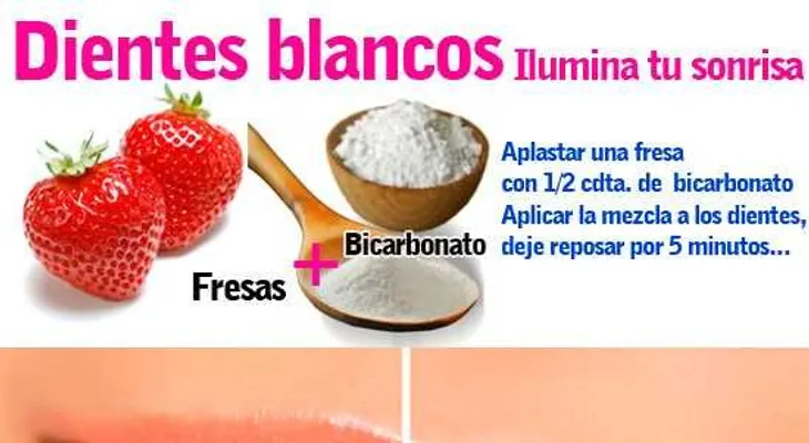 Entérate del mejor remedio para blanquear tus dientes