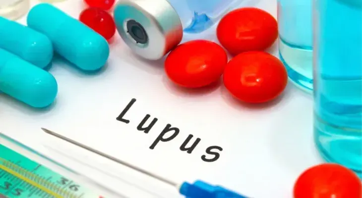 Identifican un nuevo marcador para el lupus