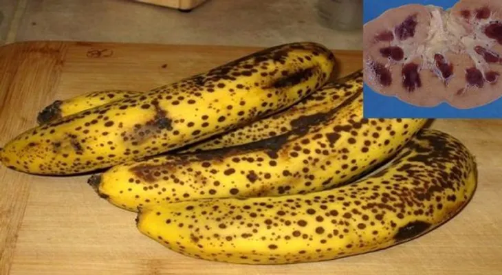 Si consume un plátano (guineo) con manchas, ni imaginas lo que hace a tu cuerpo 