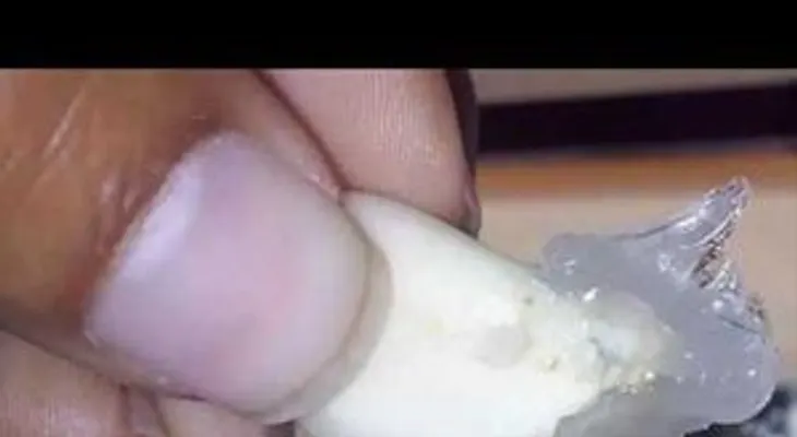 Vick vaporub y un diente de ajo para tratar enfermedades: El mejor truco del MUNDO 