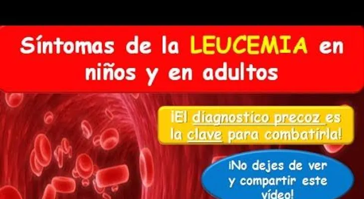 LEUCEMIA: Síntomas en niños y en adulto