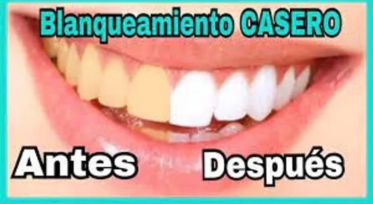 Blanquea tus dientes en 15 min con esta receta que un dentista jamás te dirá. Antes y después