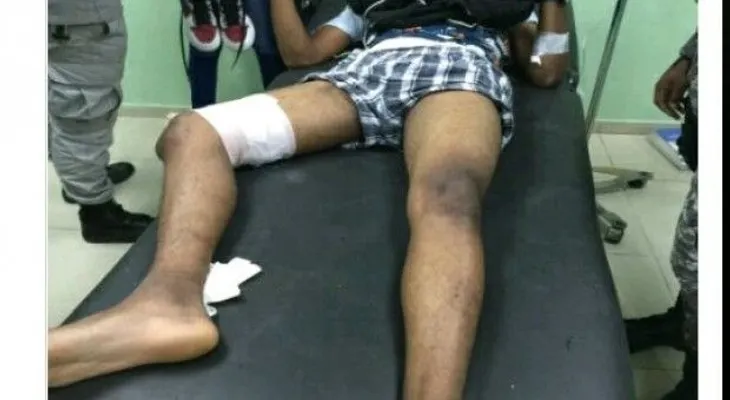 Balean raso policial en competencia clandestina de motores