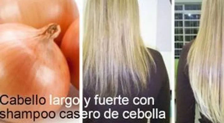 Champú de cebolla para el crecimiento del pelo. ¿Por qué no me lo dijeron antes?