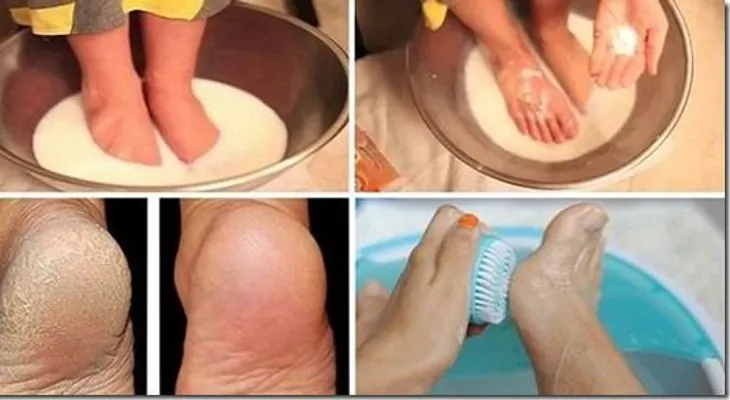 No gaste tu dinero en pedicura: Usa dos ingredientes de tu cocina para que se vean increíbles!..