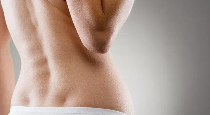 5 maneras de aliviar naturalmente el dolor de espalda por escoliosis