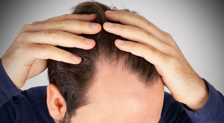 Cómo frenar la caída del cabello con estos 10 pasos
