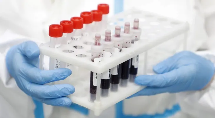 República Dominicana registra cifra record de 710 contagios en un día; fallecidos se elevan a 655