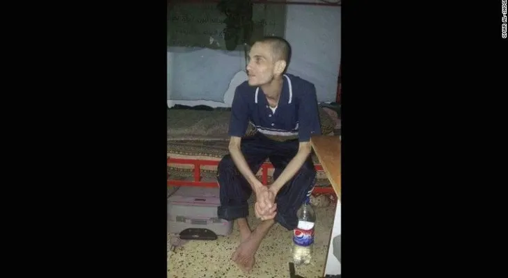 Estos hombres sobrevivieron a la tortura en una prisión siria