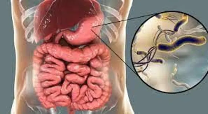 Tratamiento para combatir bacterias en el estómago o ameba