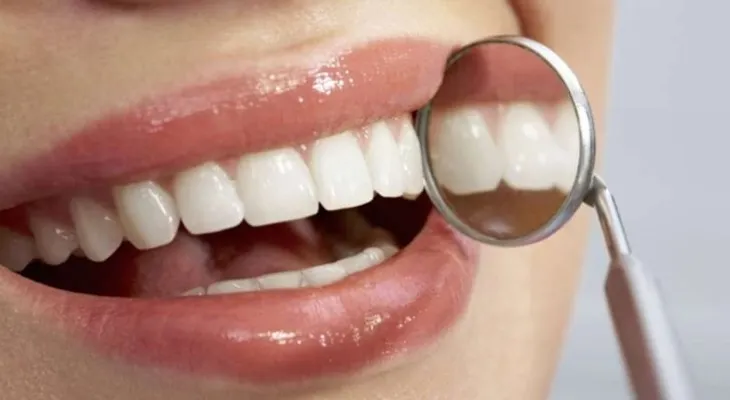 Cinco secretos para nunca tener caries