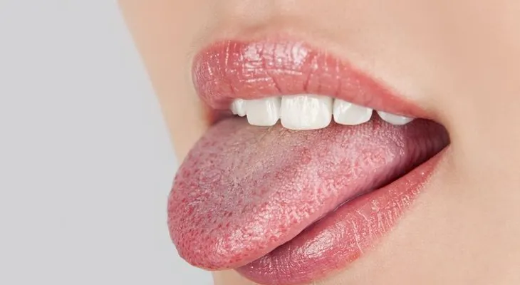 Remedios caseros para tratar la candidiasis bucal