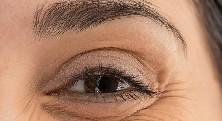 Cómo tratar la hinchazón debajo de los ojos