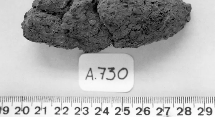 Analizan excrementos de una sociedad antigua para entender la causa de la diabetes