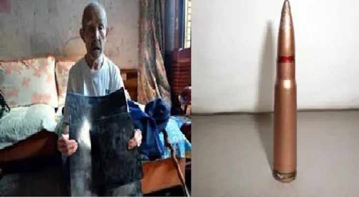 Anciano de 70 años con plomo en su vientre sin saberlo