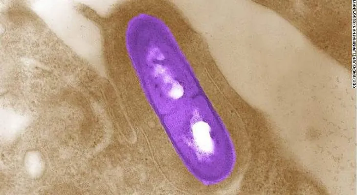 EE.UU: un muerto por brote de listeria; se sospecha de una ensalada