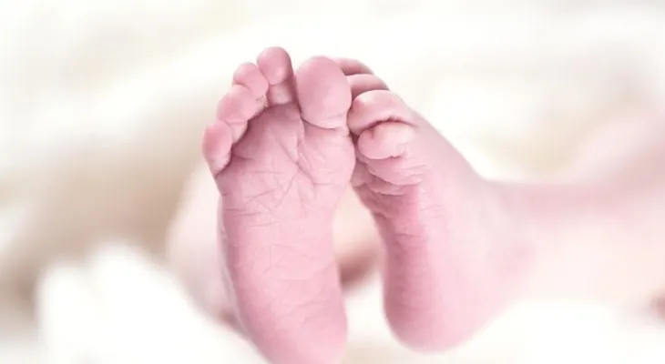 Insólito hecho en la India; nace niña con tres cabezas y causa conmoción