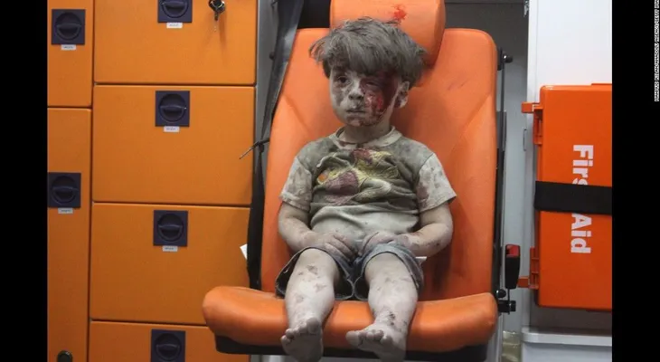 Reaparece Omran, el pequeño que se volvió el rostro del sufrimiento en Aleppo
