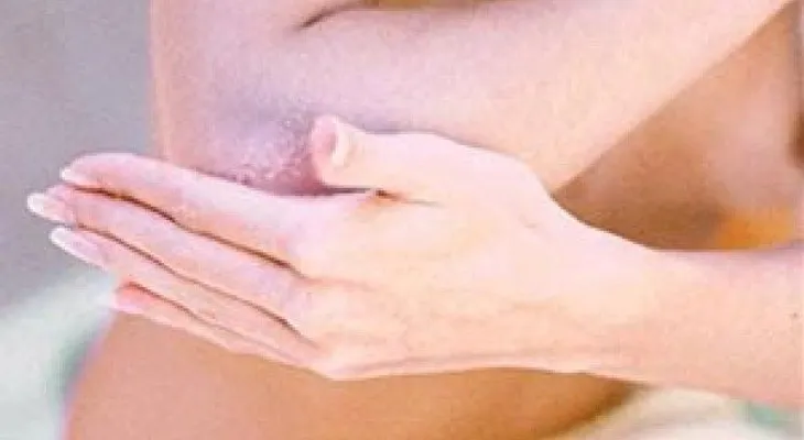 Cuando las células de la piel crecen se presenta la psoriasis