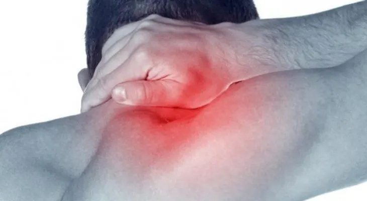 ¿Qué es y cómo se trata el síndrome del cuello roto?