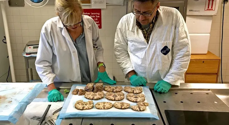 El misterioso estudio del cerebro de un joven de 27 años que se suicidó en prisión e impactó a los científicos
