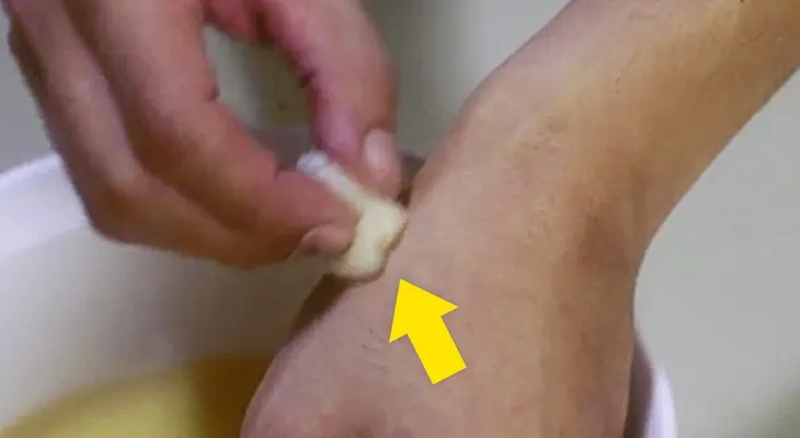 Untó su piel con vinagre de sidra de manzana para conseguir esto? ¡No tenía ni idea!