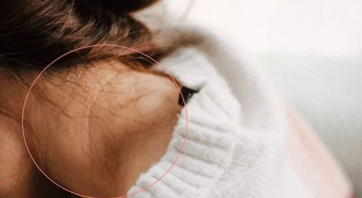 Remedios para eliminar las arrugas del cuello