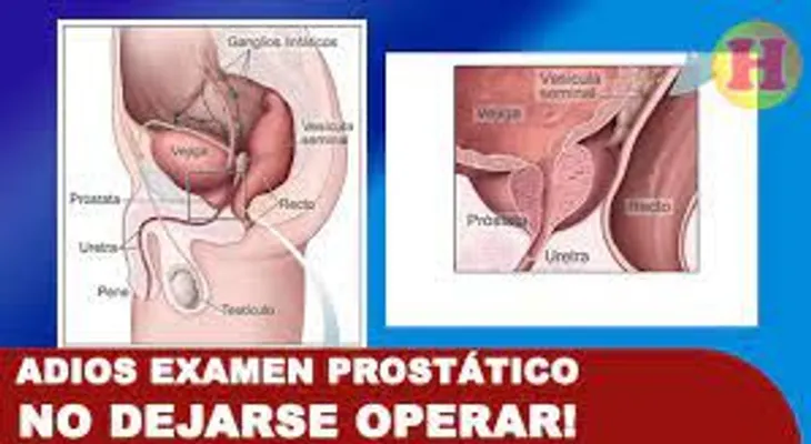 Grupo de Medicina Norteamericano testimonia que la próstata es intocable, y que nunca se deje operar 