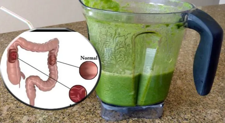 Aprende a mantener saludable tu colon y pierde 5 kilos en 1 semana con este remedio natural