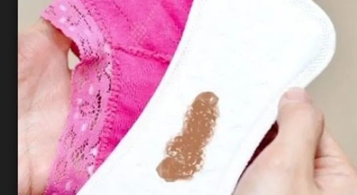 El flujo vaginal color marrón no debe asustar tanto. Tratamiento 