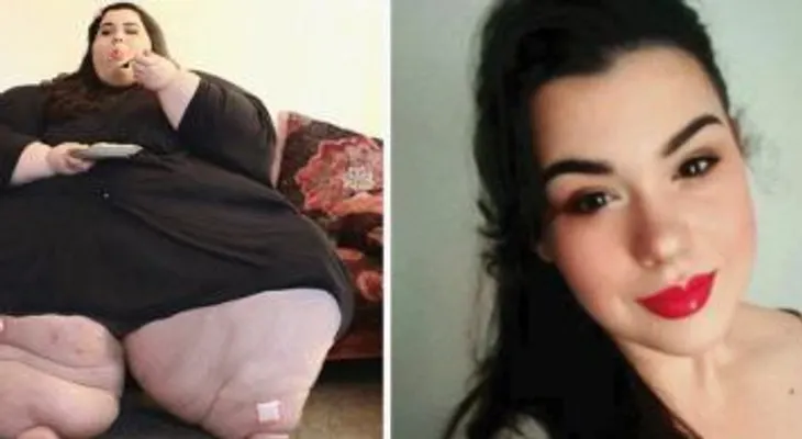 Esta mujer pesaba 298 kilos, perdió 50 kg y su cambio te dejará impactado