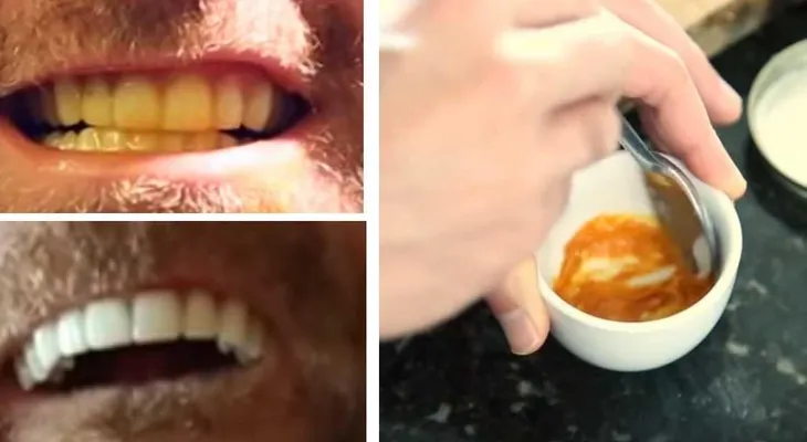Este hombre tiene un truco ridículamente simple para blanquear sus dientes. Tan sólo usa pasta y un ingrediente secreto