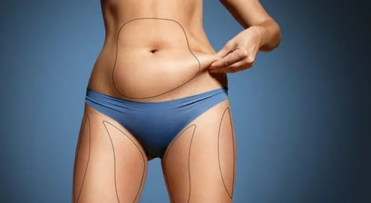 ¿Cómo calcular la grasa corporal? Te enseñamos