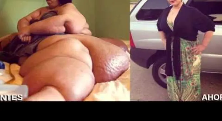 La mujer más gorda del mundo logró un cambio increíble 