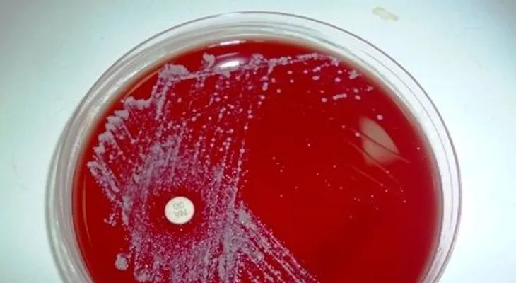 4 medicamentos para tratar la Candidiasis que puedes usar tu médico