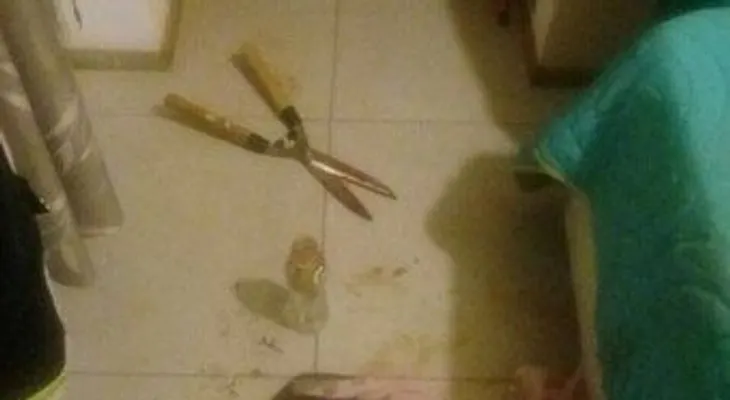 Una mujer le corta el pene y los testículos a su amante para "protegerse de un ataque sexual" 
