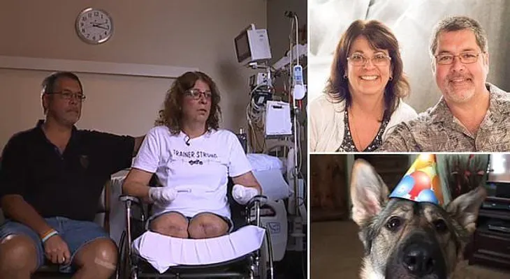 Amputan brazos y piernas a una mujer por una infección causada por lamedura de su perro
