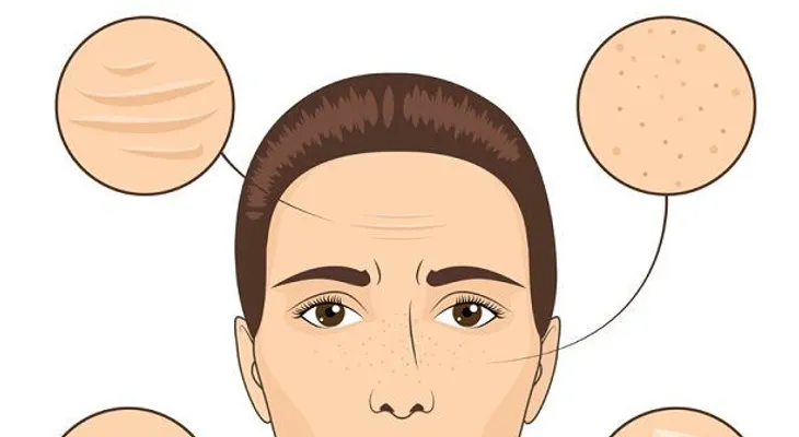 4 consejos para tener una piel más limpia