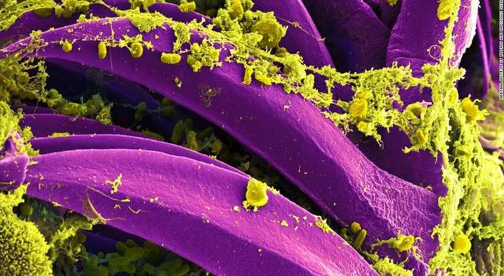 Confirman nuevo caso de peste bubónica en Oregon