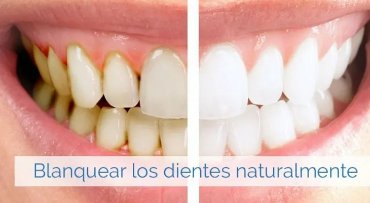 Blanquea tus dientes de manera natural 