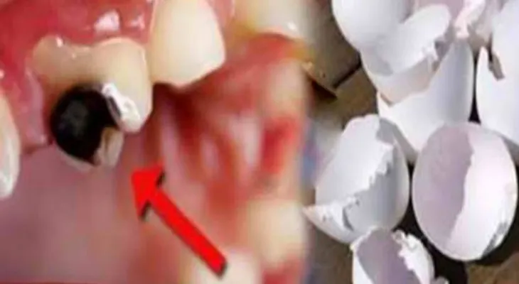 Usted no sabe lo que las cáscaras de huevo puede hacer por sus dientes. Puede regenerar sus dientes tratar y eliminar las caries