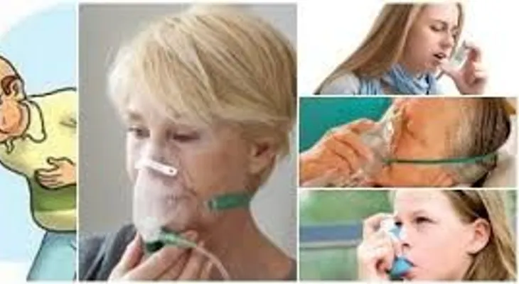 Las causas más comunes en personas con dificultad respiratoria son: Asma, neumonía o enfermedad pulmonar 